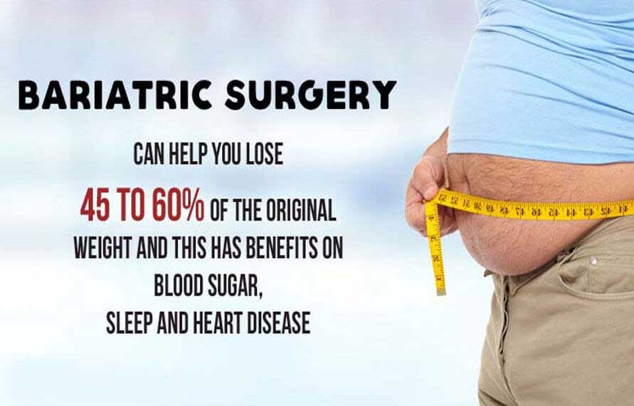 Bariatric Surgery Packages in India
