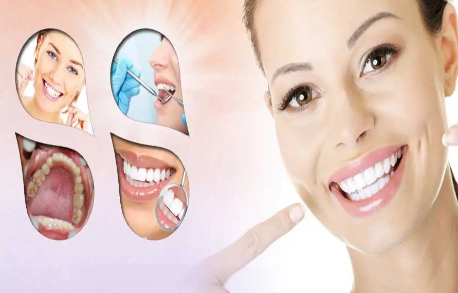 Smile Makeover